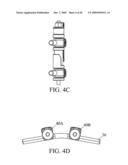 System and Method for Replacement of Spinal Motion Segment diagram and image