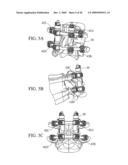 System and Method for Replacement of Spinal Motion Segment diagram and image