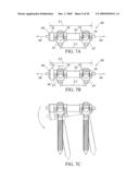 System and Method for Replacement of Spinal Motion Segment diagram and image