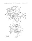 Knee Joint Prosthesis System and Method for Implantation diagram and image