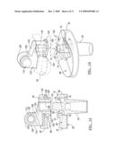 Knee Joint Prosthesis System and Method for Implantation diagram and image