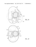 Knee Joint Prosthesis System and Method for Implantation diagram and image