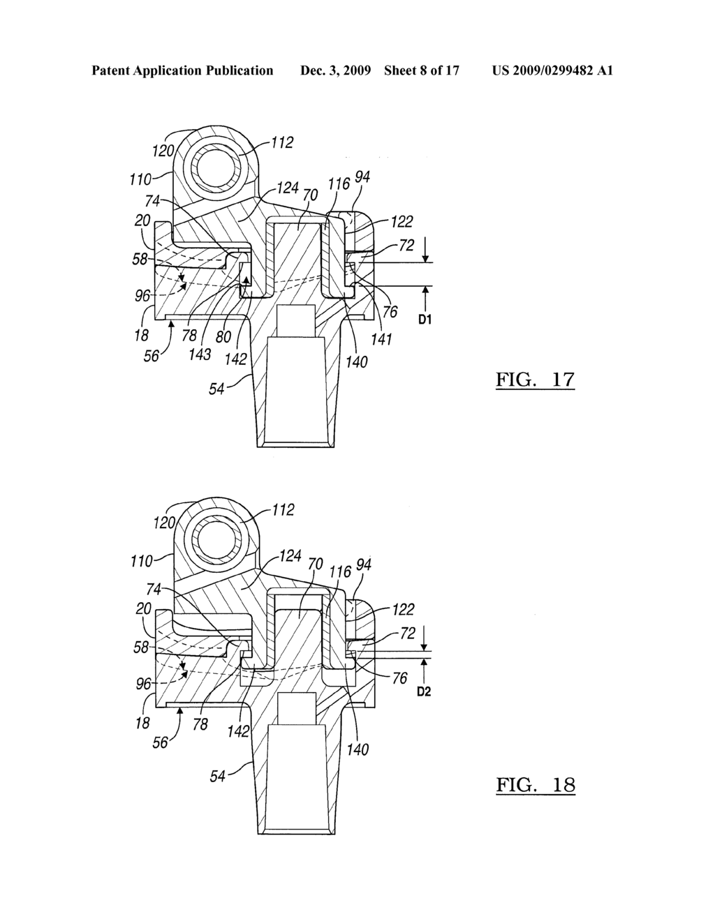 Knee Joint Prosthesis System and Method for Implantation - diagram, schematic, and image 09