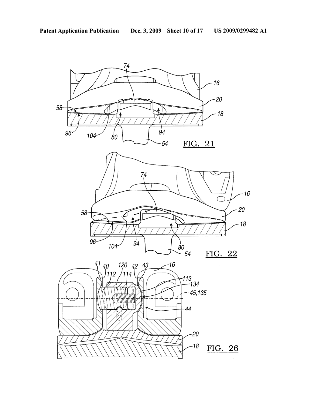 Knee Joint Prosthesis System and Method for Implantation - diagram, schematic, and image 11