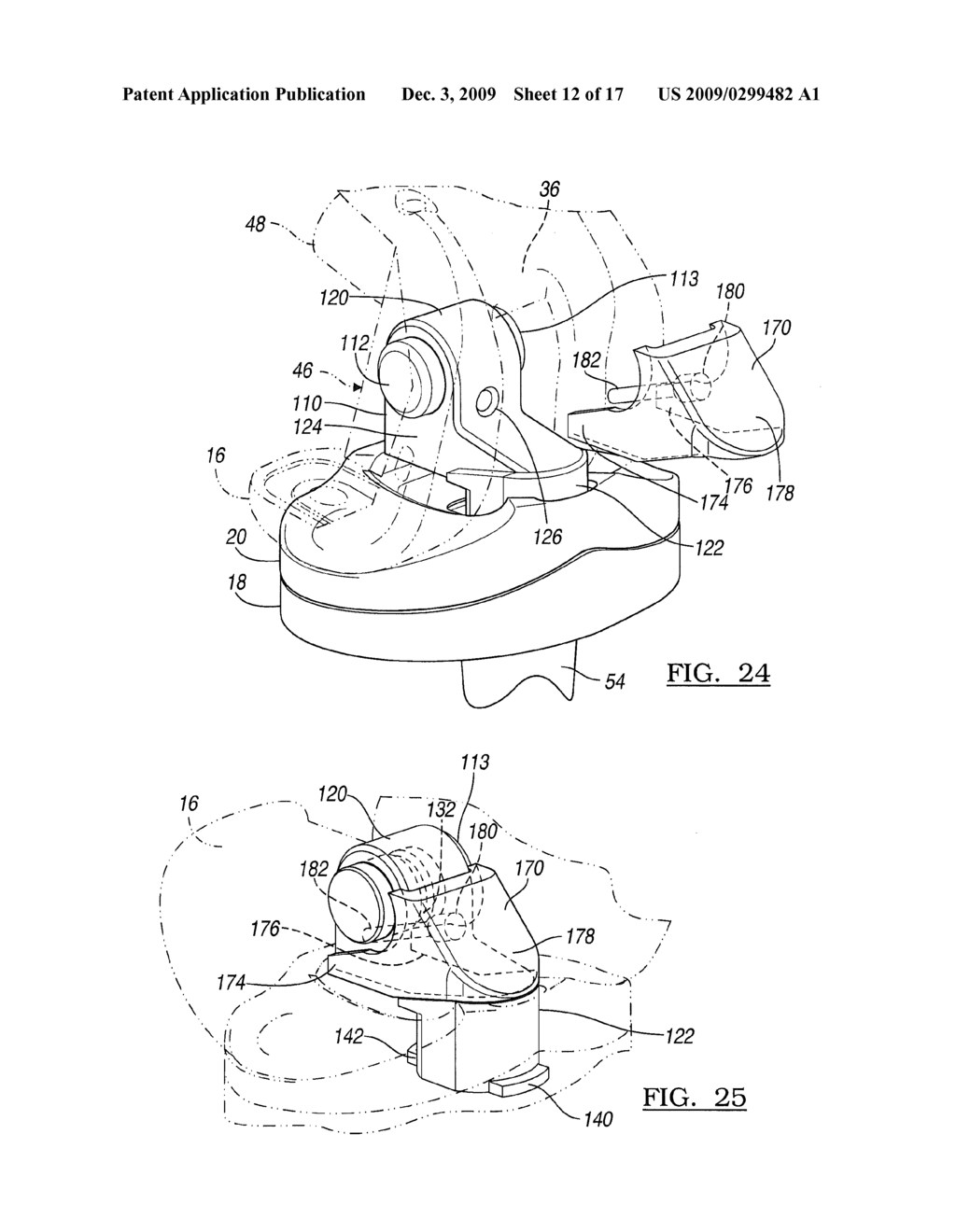 Knee Joint Prosthesis System and Method for Implantation - diagram, schematic, and image 13