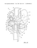 Knee Joint Prosthesis System and Method for Implantation diagram and image