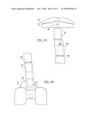 Knee Joint Prosthesis System and Method for Implantation diagram and image