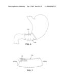 SATIATION DEVICES AND METHODS diagram and image