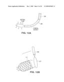 SATIATION DEVICES AND METHODS diagram and image