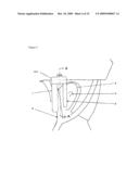 DEVICE REDUCING WIND NOISE diagram and image