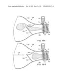 AEROSOL DELIVERY SYSTEMS AND METHODS diagram and image