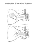 AEROSOL DELIVERY SYSTEMS AND METHODS diagram and image