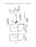 AEROSOL DELIVERY SYSTEMS AND METHODS diagram and image