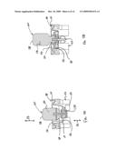 HEAT AND MOISTURE EXCHANGE UNIT WITH RESISTANCE INDICATOR diagram and image