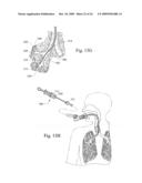 DIAGNOSTIC SAMPLE COLLECTION SYSTEM AND METHOD OF USE diagram and image