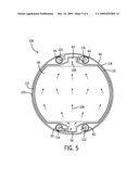 ELECTROLYZER ASSEMBLY METHOD AND SYSTEM diagram and image