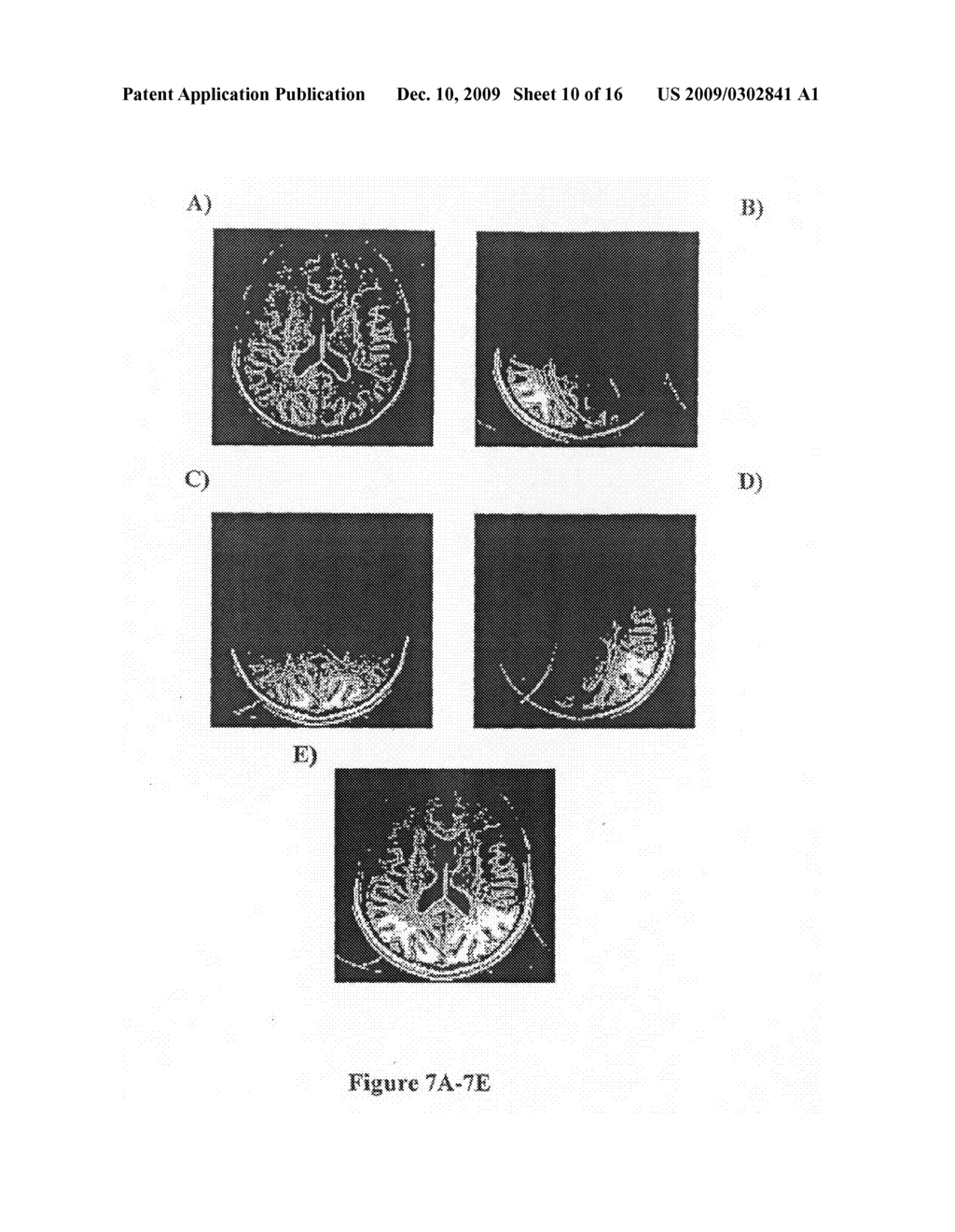 Surface Coil Arrays for Simultaneous Reception and Transmission with a Volume Coil and Uses Thereof - diagram, schematic, and image 11