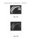 Surface parameterization method diagram and image