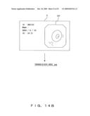 ENDOSCOPE APPARATUS diagram and image