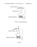 X-RAY MAMMOGRAPHY/TOMOSYNTHESIS OF PATIENT S BREAST diagram and image