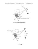 X-RAY MAMMOGRAPHY/TOMOSYNTHESIS OF PATIENT S BREAST diagram and image