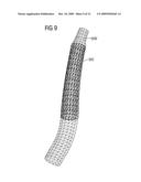 Method and simulation device for structurally individualized simulation of the introduction of a wall support element into a section of a tubular structure diagram and image