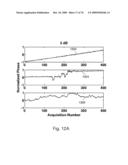 REDUCTION OF ECHO DECORRELATION FACILITATING MOTION ESTIMATION diagram and image