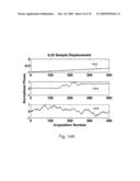 REDUCTION OF ECHO DECORRELATION FACILITATING MOTION ESTIMATION diagram and image