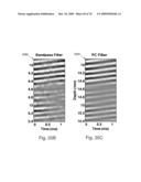 REDUCTION OF ECHO DECORRELATION FACILITATING MOTION ESTIMATION diagram and image