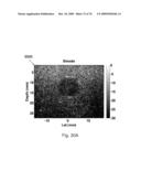 REDUCTION OF ECHO DECORRELATION FACILITATING MOTION ESTIMATION diagram and image