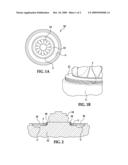 TURBOCHARGER HOUSING WITH A CONVERSION COATING AND METHODS OF MAKING THE CONVERSION COATING diagram and image