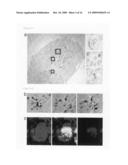 Method for preparing an organ for transplantation diagram and image