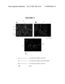 Production of Neural Stem Cells from Bone Marrow Tissue and Use Thereof diagram and image