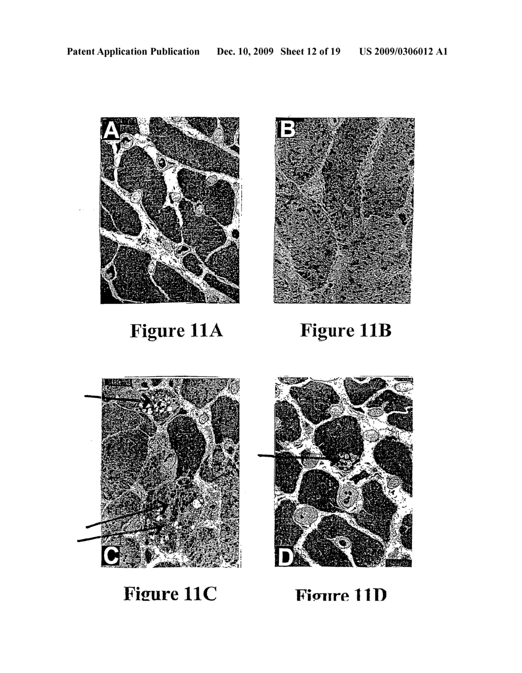 THERAPEUTIC PROTOCOLS - diagram, schematic, and image 13