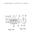 Implant for Treating the Internal Walls of a Resection Cavity diagram and image