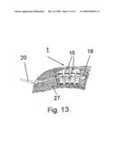 Implant for Treating the Internal Walls of a Resection Cavity diagram and image