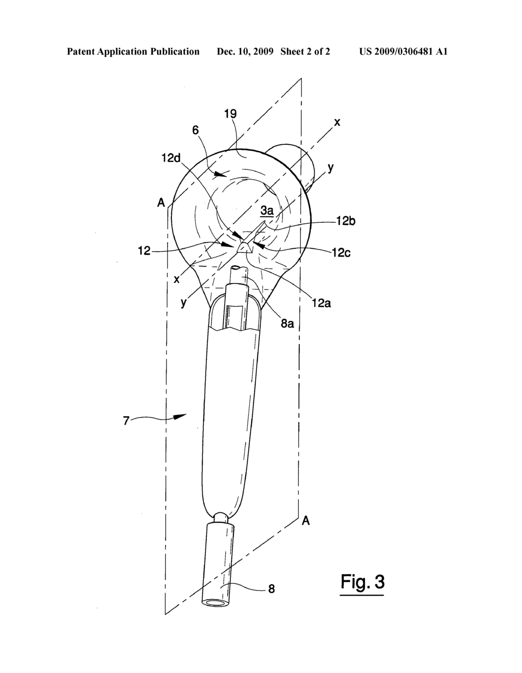 MEDICAL SURGICAL DEVICE FOR TREATING COLOPROCTOLOGICAL PATHOLOGIES - diagram, schematic, and image 03