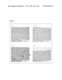 ULTRASONIC MEDICAL APPARATUS diagram and image