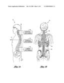 CERVICAL SPINE TRACTION APPARATUS AND METHOD diagram and image