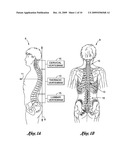 INTERMITTENT LUMBAR TRACTION APPARATUS AND METHOD diagram and image