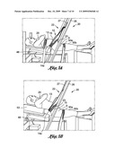 INTERMITTENT LUMBAR TRACTION APPARATUS AND METHOD diagram and image