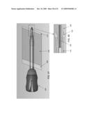 LATERALLY-EXPANDABLE ACCESS CANNULA FOR ACCESSING THE INTERIOR OF A HIP JOINT diagram and image