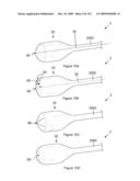 INFLATABLE MEDICAL DEVICES diagram and image