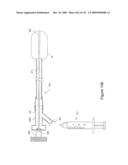 INFLATABLE MEDICAL DEVICES diagram and image