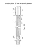 INFLATABLE MEDICAL DEVICES diagram and image