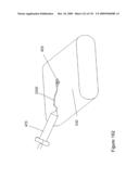 INFLATABLE MEDICAL DEVICES diagram and image