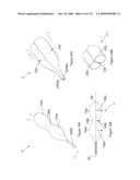 INFLATABLE MEDICAL DEVICES diagram and image