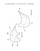 INFLATABLE MEDICAL DEVICES diagram and image