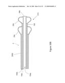 INFLATABLE MEDICAL DEVICES diagram and image