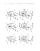 INFLATABLE MEDICAL DEVICES diagram and image